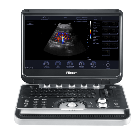 Máy siêu âm xách tay Doppler màu Finus 50
