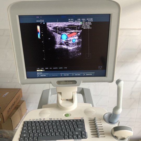 Máy Siêu Âm 2D Màu Samsung Medison X6